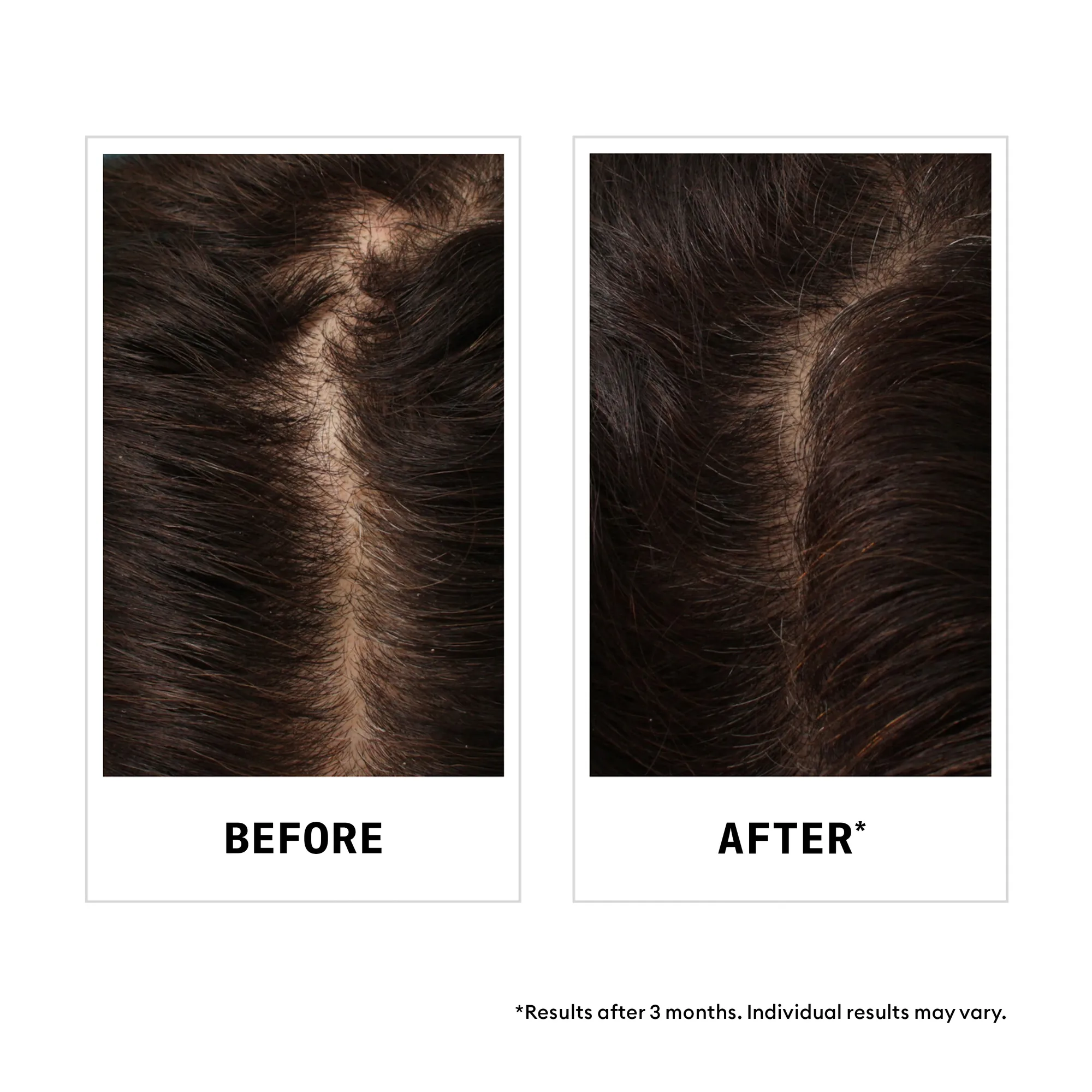 Nioxin Hair Fall Defense Shampoo