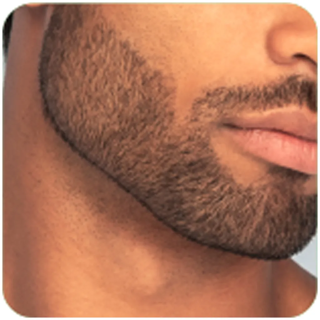 Remington T-Series Ultimate Precision Trimmer MB7000