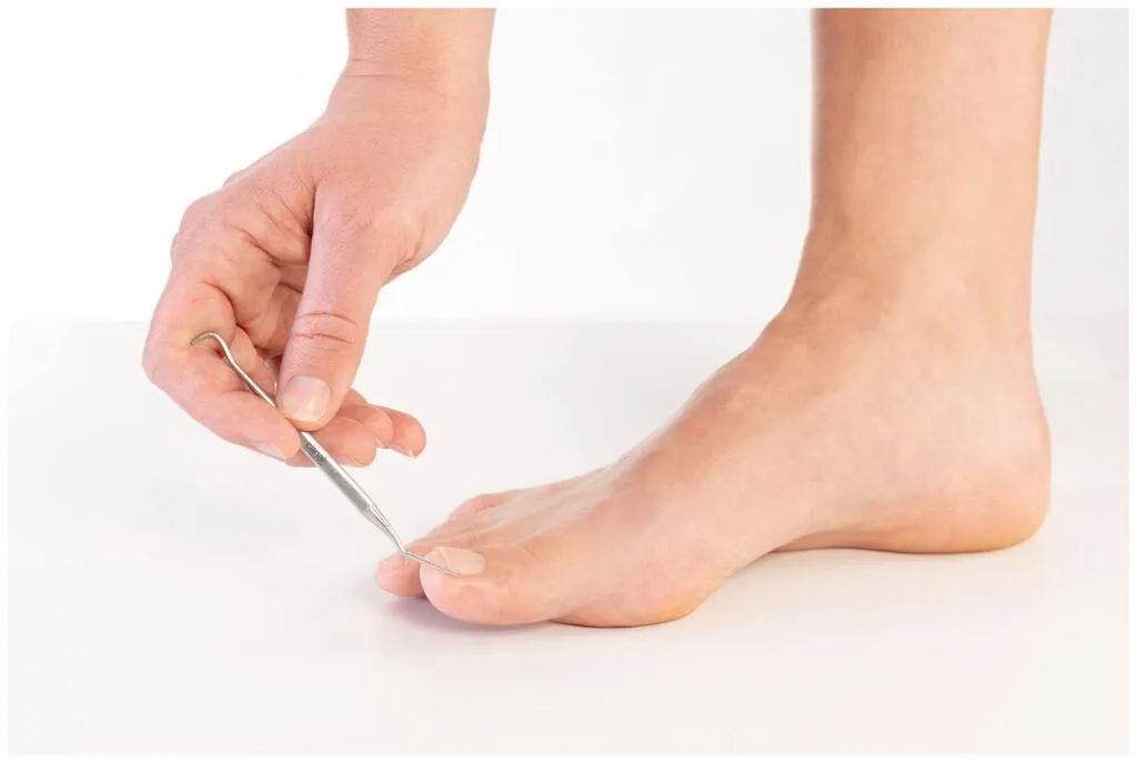 Canal Ingrown Toenail File 10 cm