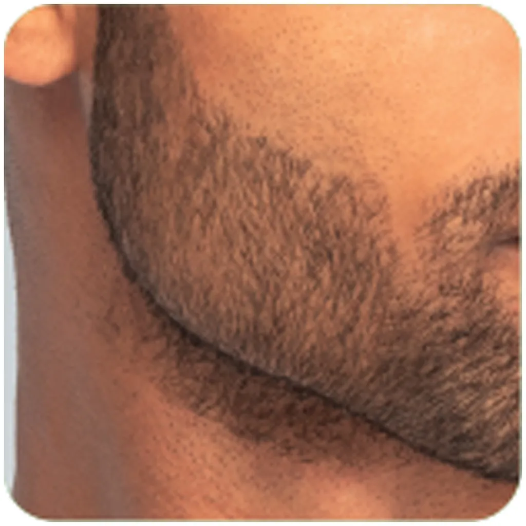 Remington T-Series Ultimate Precision Trimmer MB7000